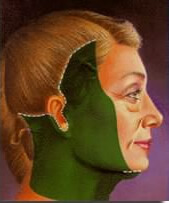 lifting_facial_2.jpg
