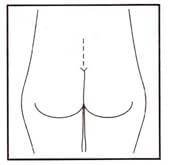 protesis_de_gluteos_1.jpg